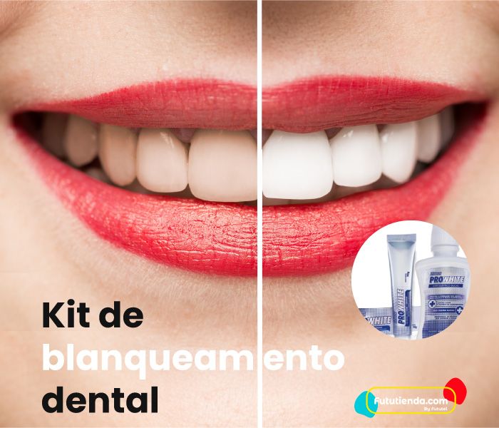 Kit De Blanqueamiento Dental Fututienda